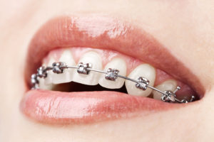 Estudiar el grado en odontología: Especialidad en Ortodoncia